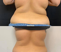 2-slimming-give-photo-credit-to-_core_nutrition_wellness.jpg