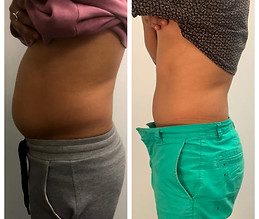 8-slimming-treatments-give-credit-to-_thrivecryostudio.jpg