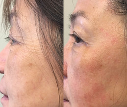 facial 2.JPG