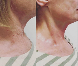 Neck toning.png