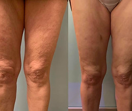 3-toning-2-slimming-treatments.jpg