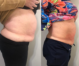 5 slimming.jpg