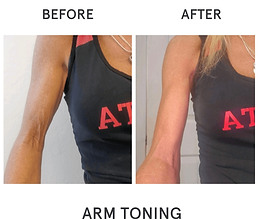 Arm-Toning-BA.png