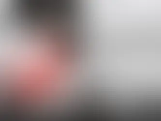 "Exploring the Role of Global Health Perspectives in Paediatric Urology: Small Bodies, Big Impact"