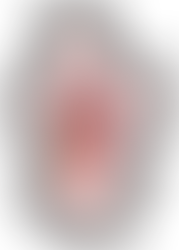 "Understanding Congenital Diaphragmatic Hernia (CDH) in Pediatric Patients: Causes, Symptoms, and Treatment"