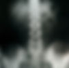 Pelvic X-Ray