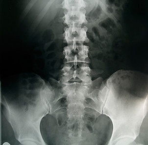 Radiologie pelvienne