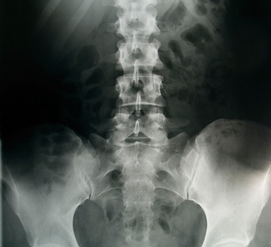 Miednicy X-Ray
