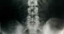 Pelvic X-Ray