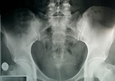 pelvic x-ray