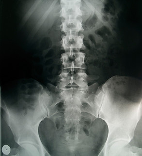 X-Ray