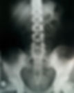 Pelviennes X-Ray