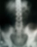 Daytona Beach Chiropractor