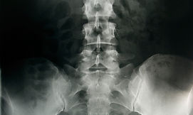 Pelvic X-Ray