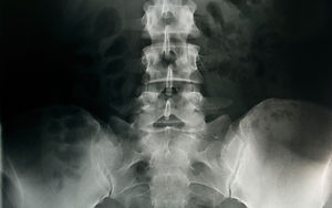 Pelvic X-Ray