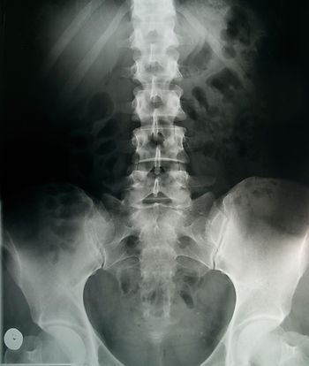 Ogden Utah Chiropractor x-ray