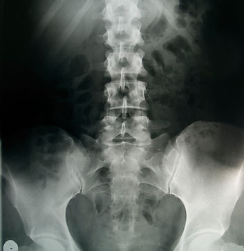 Spinal X-ray Scan