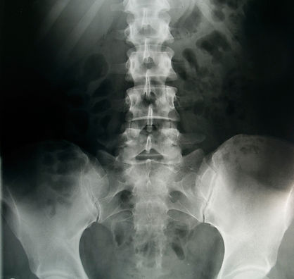 Pélvica X-Ray