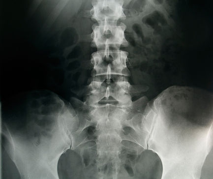 Spinal X-ray Scan