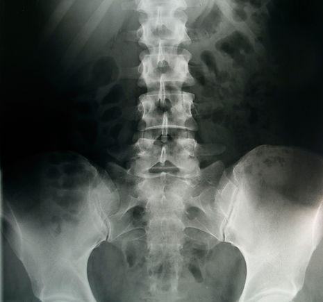 Pelvic X-Ray