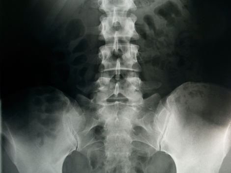 Desecho de radiografÃas
