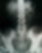 Pelvic X-Ray