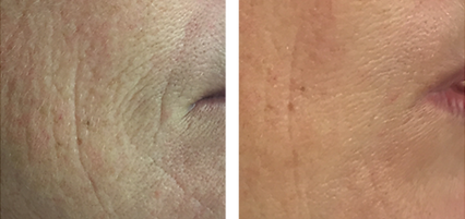 before-after-4.png