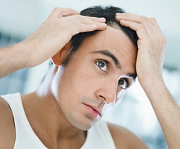 hairloss-450x411.webp