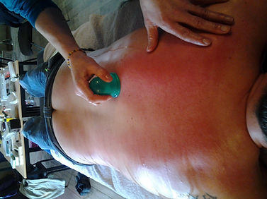massage-ventouse.jpg
