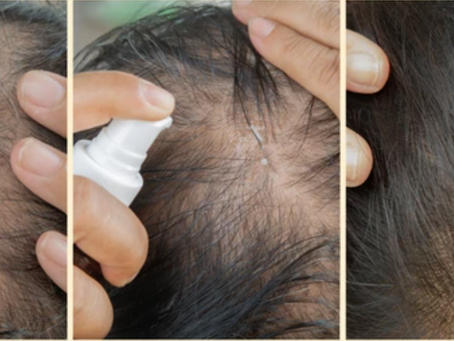 Biologic advances hair regrowth and rejuvenation