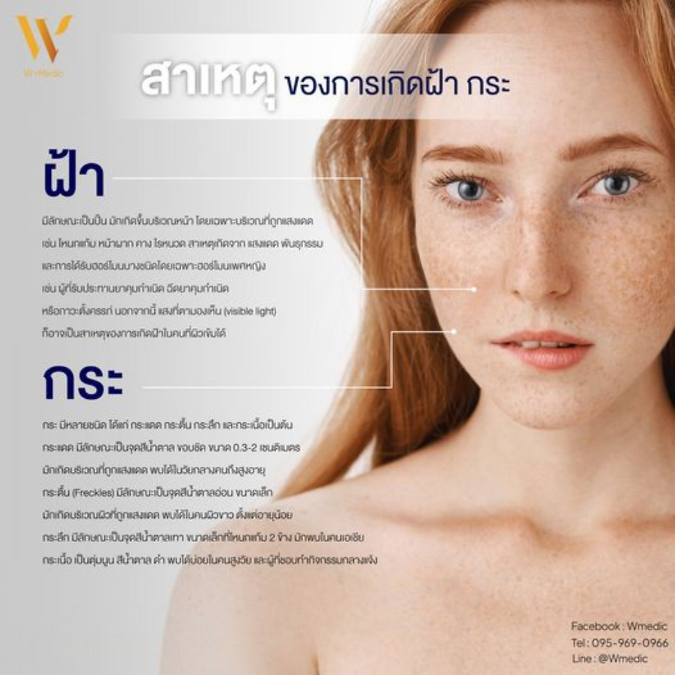สาเหตุของฝ้ากระปัญหาผิวที่พบได้บ่อย ฝ้าและกระเป็นปัญหาผิวที่หลายคนประสบปัญหาอยู่บ่อยครั้ง โดยเฉพาะในผู้หญิงที่มีอายุเพิ่มขึ้น