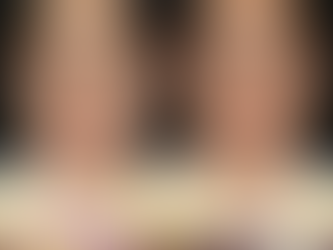 เคลียร์ผิวให้สะอาดขึ้นในครั้งเดียว เลเซอร์CO2 ใบหน้า ที่ W+ Medic Clinic