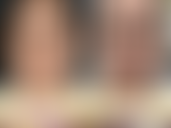 จุดเล็ก ๆ ที่เคยมองข้าม … กลับทำให้ผิวดูไม่สวยเท่าที่ควร (เลเซอร์CO2)