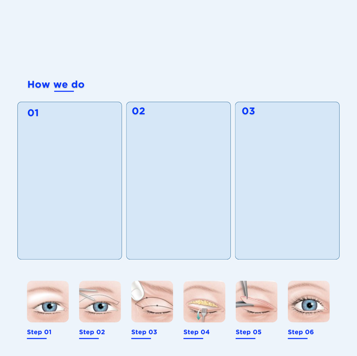 ตาสองชั้น UX UI_เก่ง แกะลงWIX (16).png