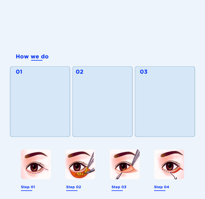 ตาสองชั้น UX UI_เก่ง แกะลงWIX (22).png