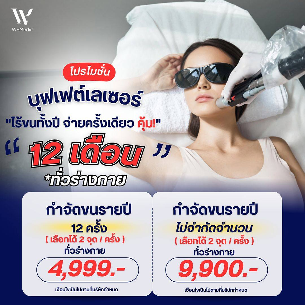 บุฟเฟต์เลเซอร์