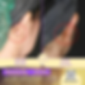 รีวิวรักษาคีลอยด์ “หลังใบหู” ด้วยการผ่าตัด