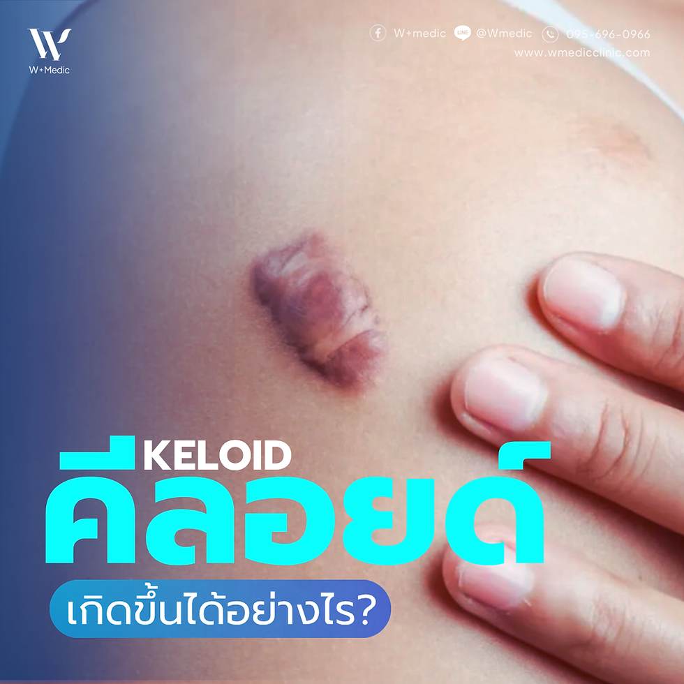 KELOID