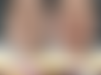 เลเซอร์CO2 ช่วยกำจัดจี้กระบนใบหน้า – ทางเลือกของคนที่อยากคืนความมั่นใจ