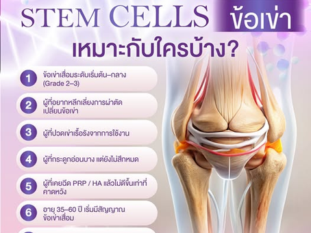 สเต็มเซลล์ข้อเข่า เหมาะกับใครบ้าง?