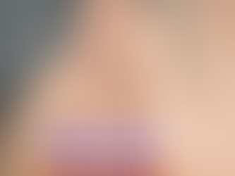 คีลอยด์ใบหูขนาดเล็ก (Early Keloid)