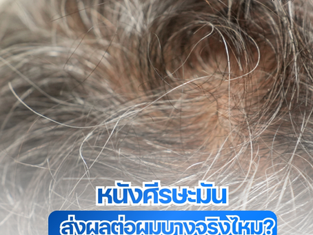 หนังศีรษะมัน... จุดเริ่มต้นของปัญหาผมบาง จริงไหม?