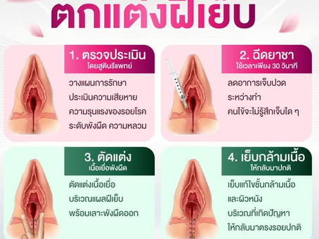 ขั้นตอนการผ่าตัดตกแต่งฝีเย็บอย่างปลอดภัย