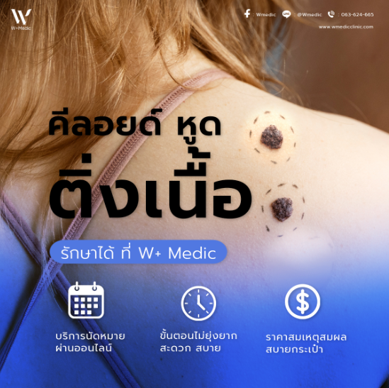 กําจัดหูดติ่งเนื้อ W+medic เวสเกต นนทบุรี