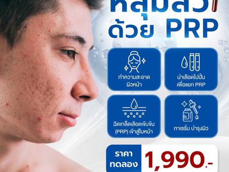 บูสต์ผิวให้เต็ม ดูแลปัญหาหลุมสิวด้วยโปรแกรม PRP 💉✨