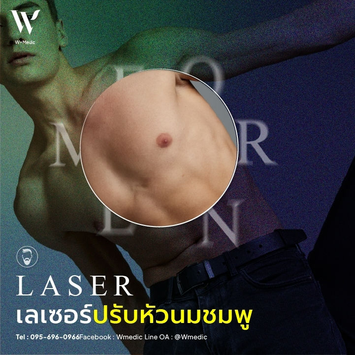 การทำให้หัวนมชมพูด้วยวิธีการเลเซอร์ เป็นวิธีที่ให้ผลเร็วไม่ต้องพักฟื้นนาน!!!