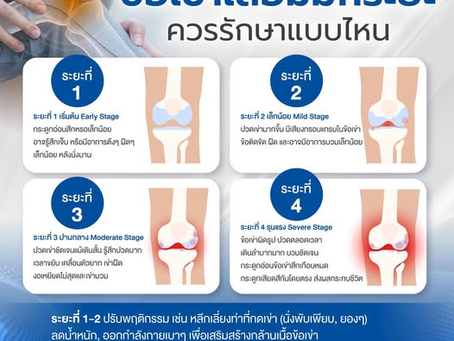  ข้อเข่าเสื่อม มีกี่ระยะ?รู้ไว้… เพื่อดูแลและป้องกันได้ถูกวิธี