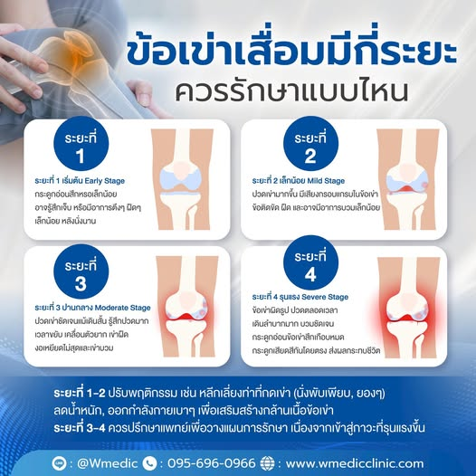 ข้อเข่าเสื่อม 