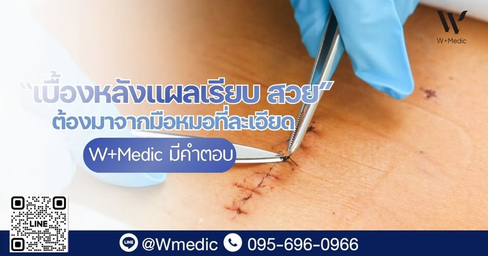 ผ่าคีลอยด์