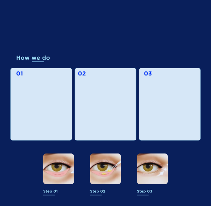 ตาสองชั้น UX UI_เก่ง แกะลงWIX (23).png